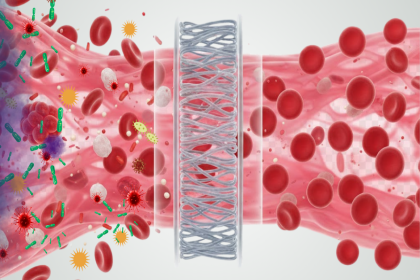 Extracorporeal Hemoperfusion as Supportive Cancer Therapy
