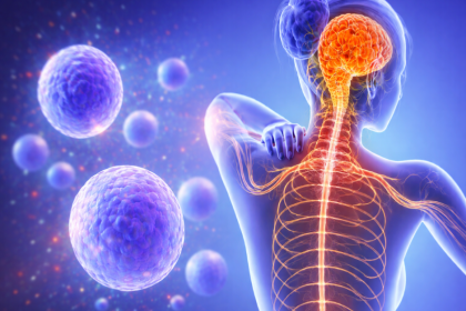 Stem Cell Therapy for Multiple Sclerosis