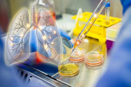 Stem Cell Therapy for Cystic Fibrosis